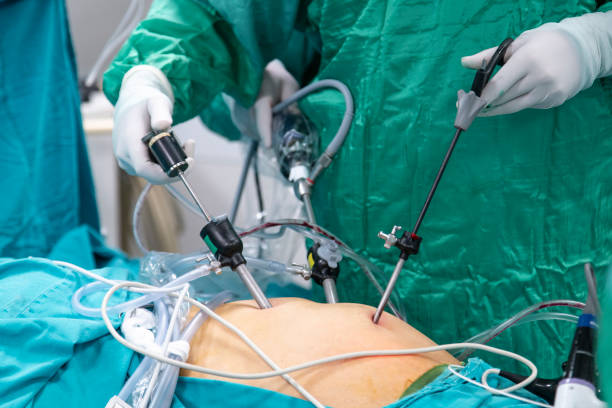Laparoscopic